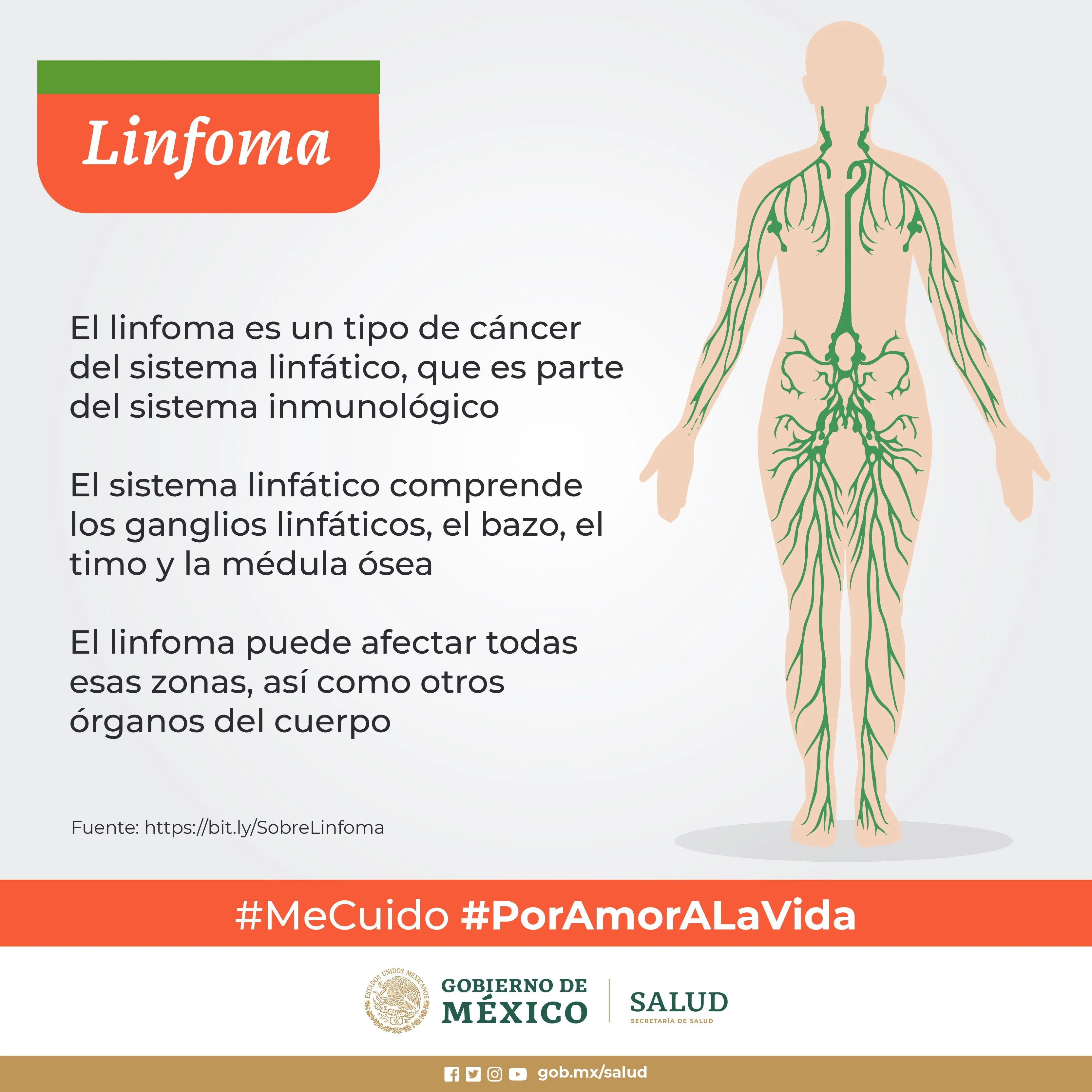 Linfoma, enfermedad oncológica que puede ser curable | Secretaría de Salud  | Gobierno | gob.mx