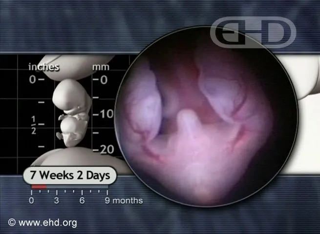 lower-embryo-at-7-weeks-2-days.jpg