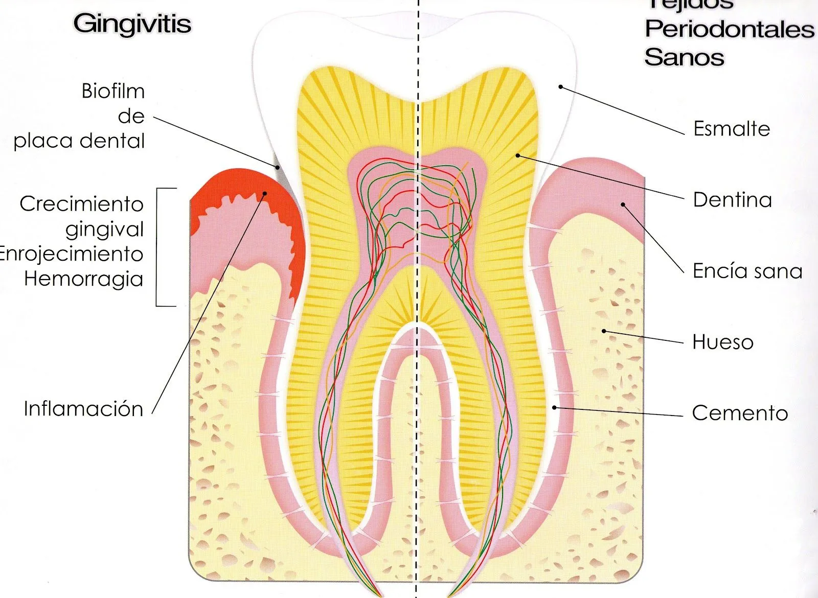 Así es mi molar (muela) por dentro | PREVENCION BUCAL Así es mi molar (muela) por dentro | PREVENCION BUCAL