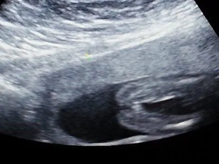 muestren el ultrasonido de niñas - Bebés Enero 2015.. Para el ...