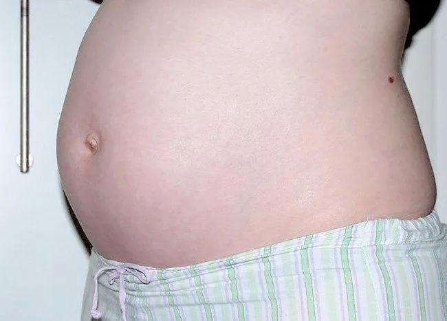 Una mujer desarrolló un feto en sus intestinos durante seis meses
