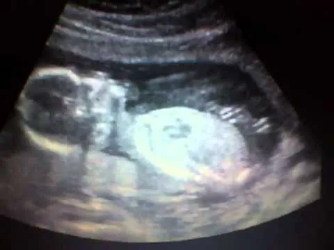 Mi niña ,ecografia a las 16 semanas de embarazo. - YouTube