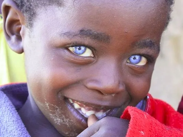 Este es el niño ojos de zafiro | soychile.cl