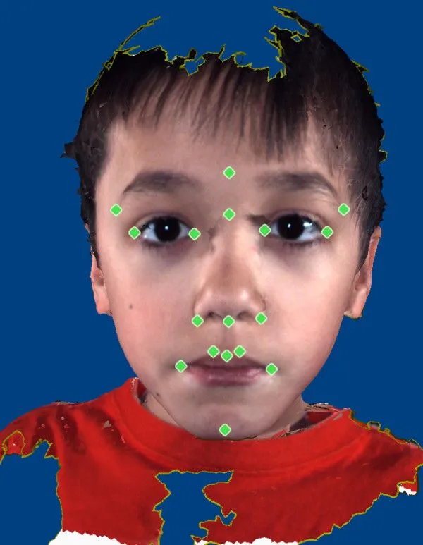 Los niños con autismo pueden presentar rasgos especiales en el rostro -  Autismo Diario
