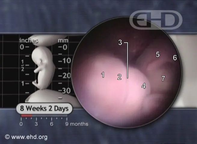 nose-and-mouth-8-weeks- ...