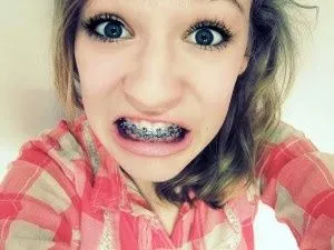 Novia con brackets?! :( - Foro Bodas.com.mx - bodas.com.mx Novia con brackets?! :( - Foro Bodas.com.mx - bodas.com.mx