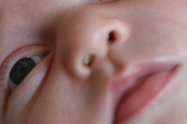 Productos Farmacéuticos Útiles: Congestión nasal I - Bebé feliz
