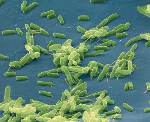 Reino Monera (Bacterias, Cianobactérias) | Escuelapedia – Recursos ...