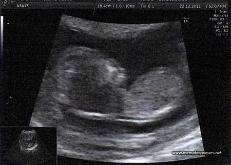 Semana 12 de embarazo: Parece niño