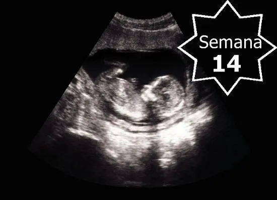 Bebé a las 14 semanas de gestacion - Imagui