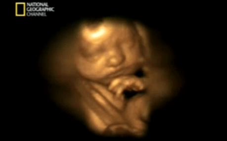 SEMANA 26: Ya está en posición fetal | Club Madres