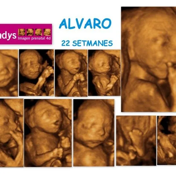 DE 20 A 25 SEMANAS | Ecodadys 4d Centro de maternidad ecografías 4d