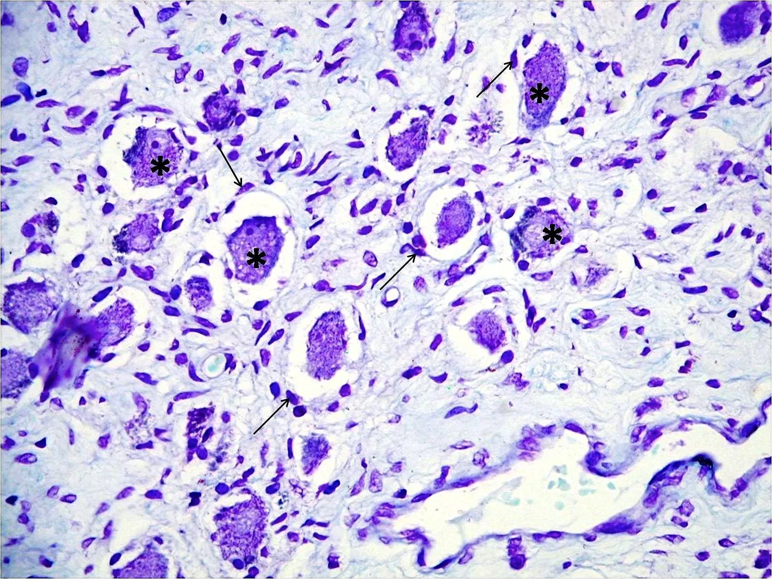 SOS BIOLOGIA CELULAR Y TISULAR: TEJIDO NERVIOSO. GANGLIO SIMPATICO ... SOS BIOLOGIA CELULAR Y TISULAR: TEJIDO NERVIOSO. GANGLIO SIMPATICO ...