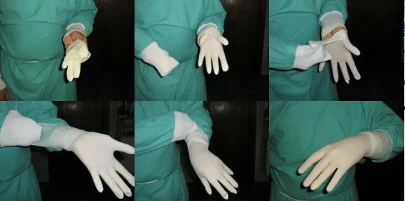 Técnicas medico-quirúrgicas enfermería: Calzado de guantes.
