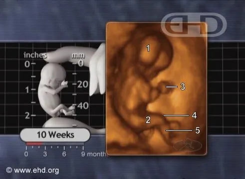 the-1-week-fetus.jpg