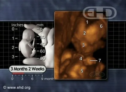 the-14-week-fetus.jpg
