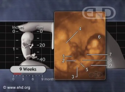 the-9-week-fetus-in-motion.jpg
