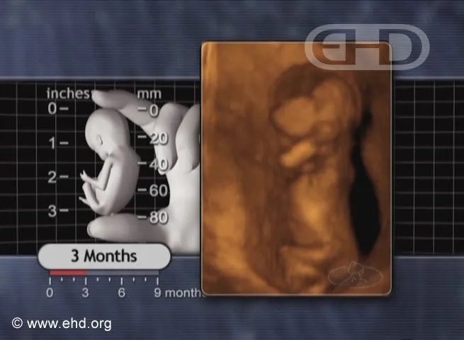 three-month-fetus.jpg