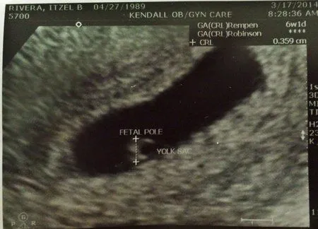 Primer Ultrasonido - ❤ Bebés de Noviembre 2014 ❤ - BabyCenter