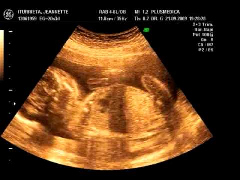 Valeria Trinidad 5 meses de embarazo - YouTube