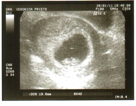 Viraflow: La primera imagen el Bebé!!