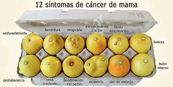 12 signos y señales que pueden indicar un cáncer de mama