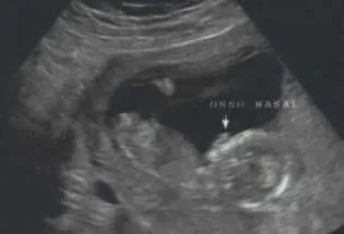 14 semanas