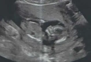 14 semanas
