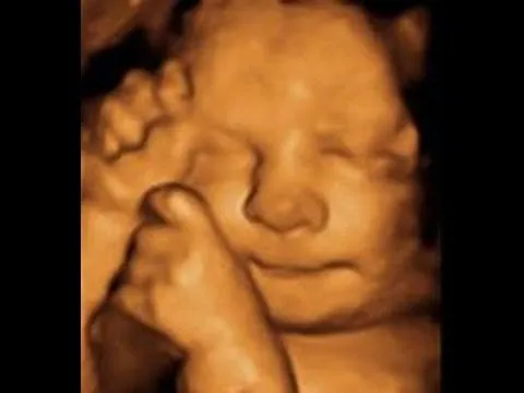 18 semanas eco en 3D,el sexo de mi bebé?!♥ Embarazo y mucho mas ... 18 semanas eco en 3D,el sexo de mi bebé?!♥ Embarazo y mucho mas ...