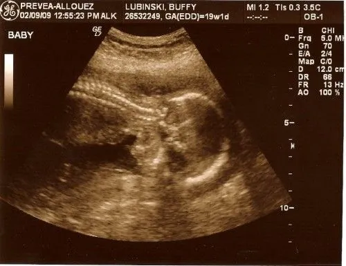 19ª semana del embarazo : Bebes y embarazo