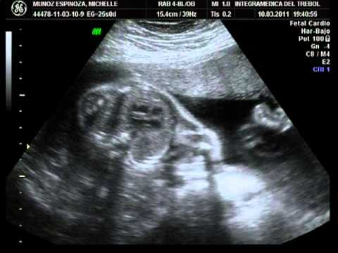 2ª Ecografía de mi bebé, 24 semanas de gestación - YouTube 2ª Ecografía de mi bebé, 24 semanas de gestación - YouTube