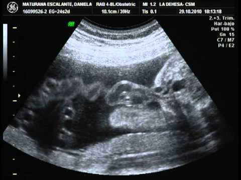 24 semanas de embarazo - YouTube