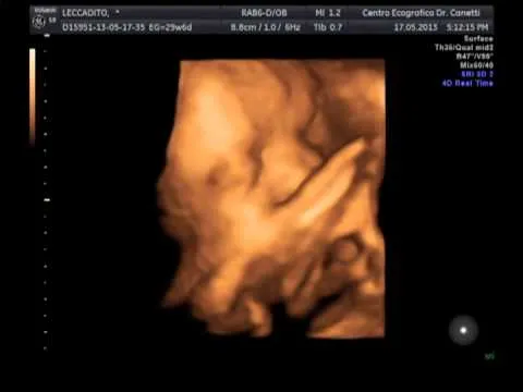 30 semanas de embarazo y mi bebe se rie - YouTube