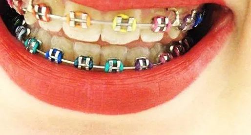 Brackets falsos - Imagui