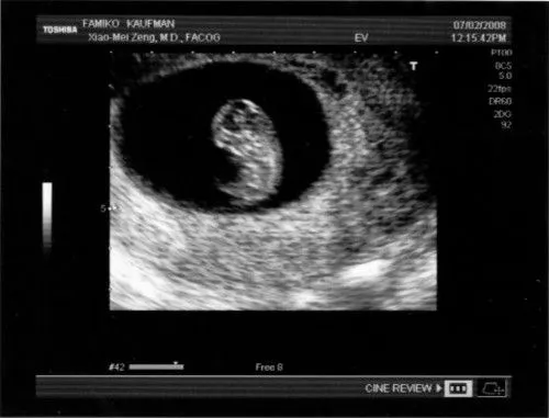 8ª semana del embarazo : Bebes y embarazo