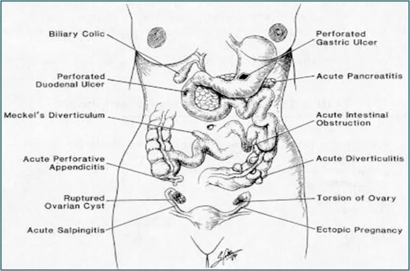 peritoneo visceral - imponer.comyr.com