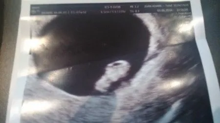 Aborto espontáneo - Página 21 - Futuras Mamás - Foro Bodas.net Aborto espontáneo - Página 21 - Futuras Mamás - Foro Bodas.net