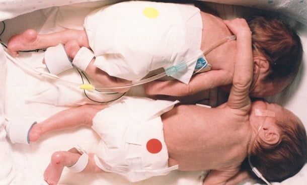 El abrazo salvador (y lo que nos enseñó) - Somos Múltiples