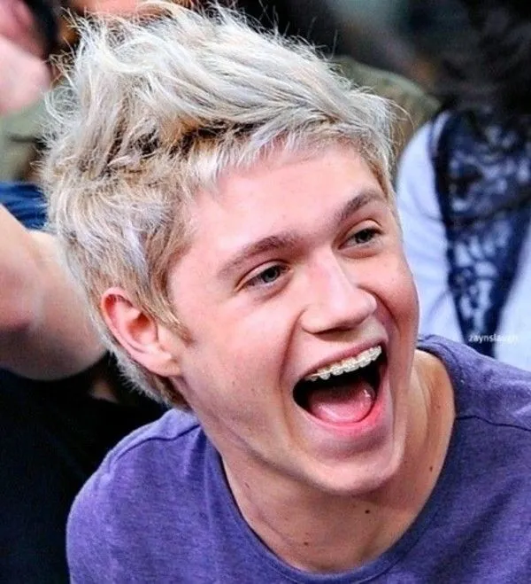 Niall Horan: Bye bye, braces! | Literarily Laura Niall Horan: Bye bye, braces! | Literarily Laura