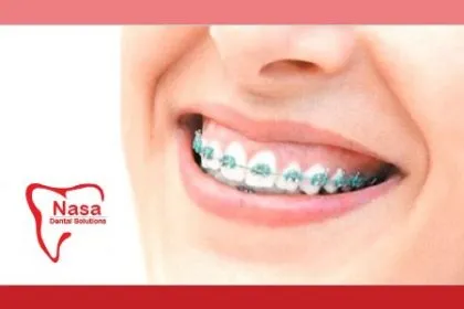 ¡Corrige tu Sonrisa! Paga RD$4,950 en vez de RD$28,000 por ... ¡Corrige tu Sonrisa! Paga RD$4,950 en vez de RD$28,000 por ...