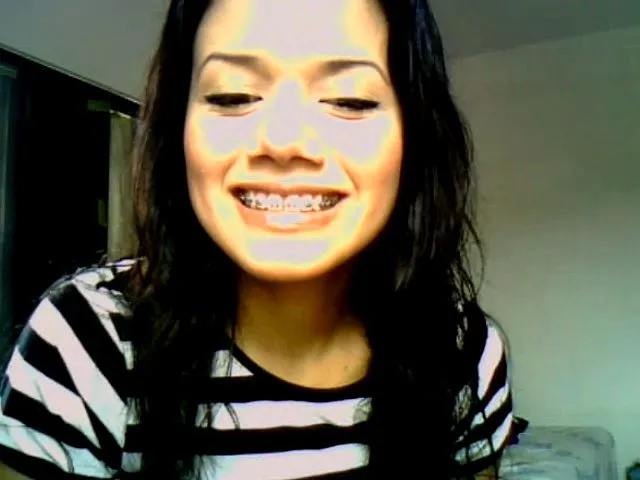 Adios a los brackets? - Taringa!