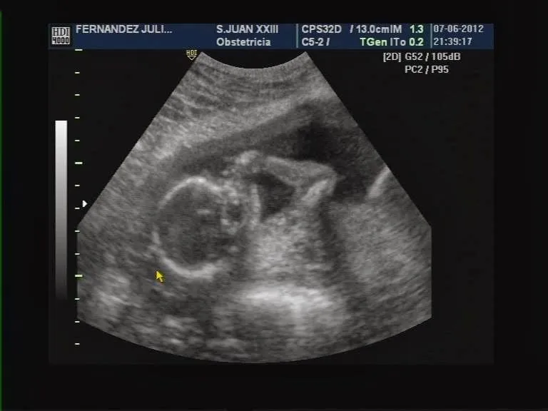 Imagenes de bebés en la panza - Imagui