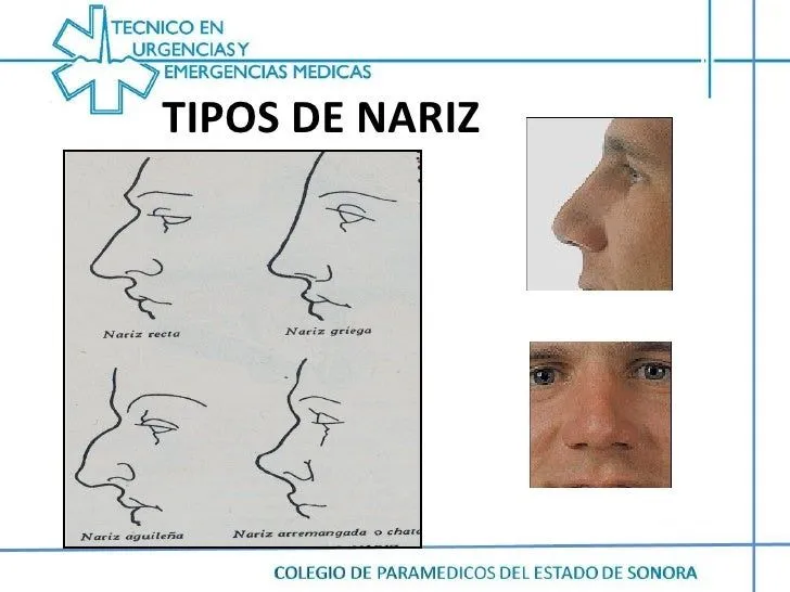 Anatomia cabeza