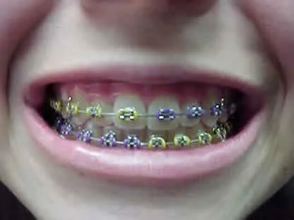 Annalicious Online-SHOP: PROMO BEHEL NON-PERMANENT Annalicious Online-SHOP: PROMO BEHEL NON-PERMANENT