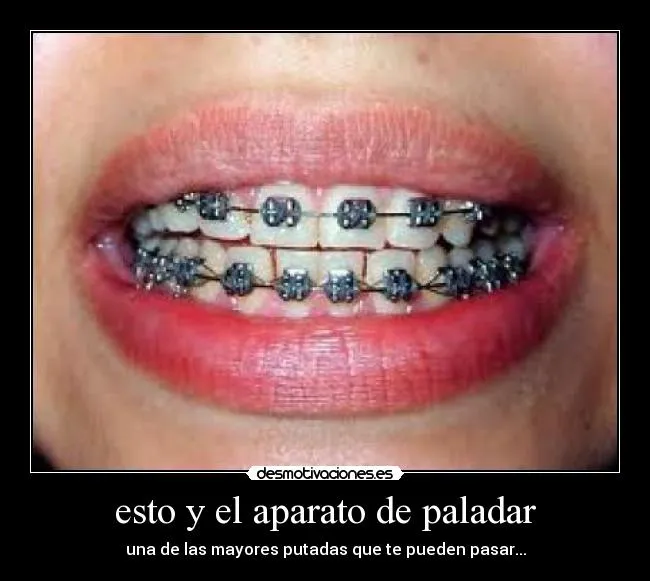 esto y el aparato de paladar | Desmotivaciones