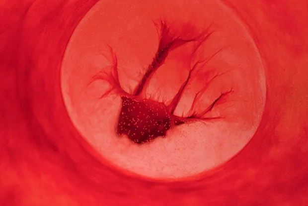 Artista usa su sangre menstrual para crear hermosos paisajes ... Artista usa su sangre menstrual para crear hermosos paisajes ...