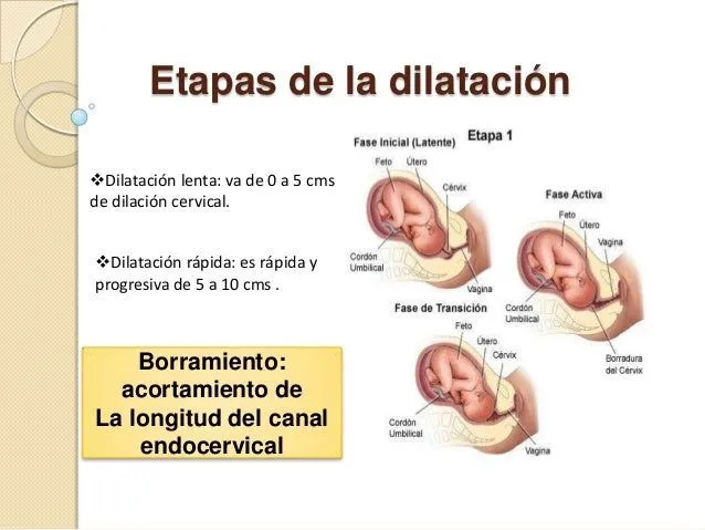 Asistencia del trabajo de parto