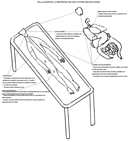 Atlas de medicina forense (página 2) - Monografias.com Atlas de medicina forense (página 2) - Monografias.com