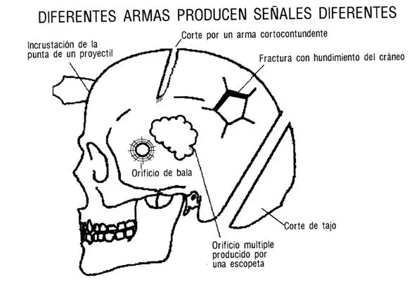 Atlas de medicina forense (página 3) - Monografias.com