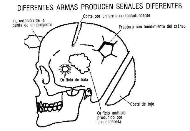 Atlas de osteología humana (página 5) - Monografias.com